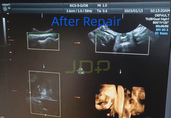 إصلاحات الـ RIC5-9-D
