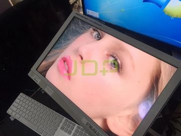 سترايكر 26 بوصة الرؤية الاختيار HD رصد داخلي / جراحي